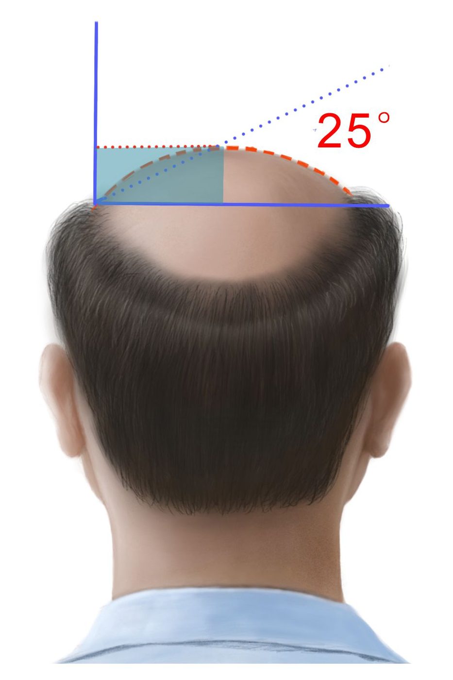 B 弧度 25°